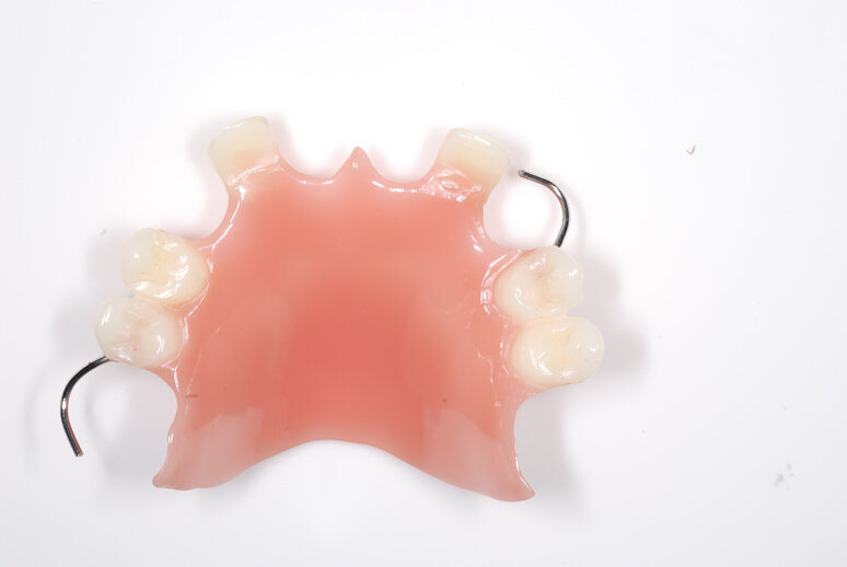 Съемный акриловый протез при частичном отсутствии зубов АКЦИЯ