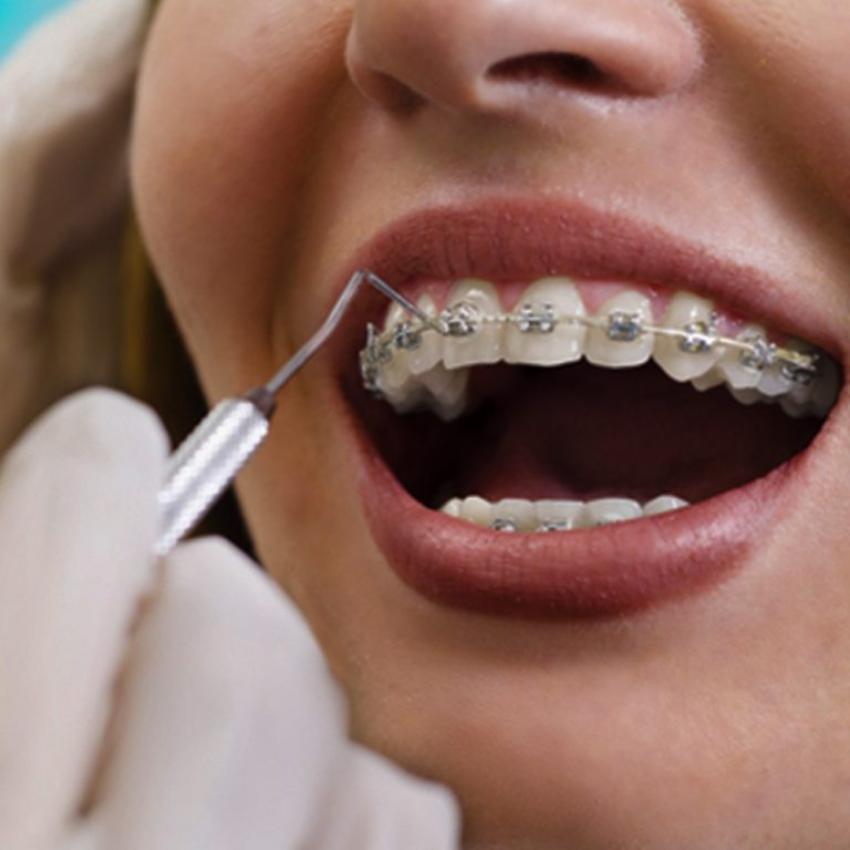 Взаимосвязь между ортодонтическим здоровьем и движением против буллинга