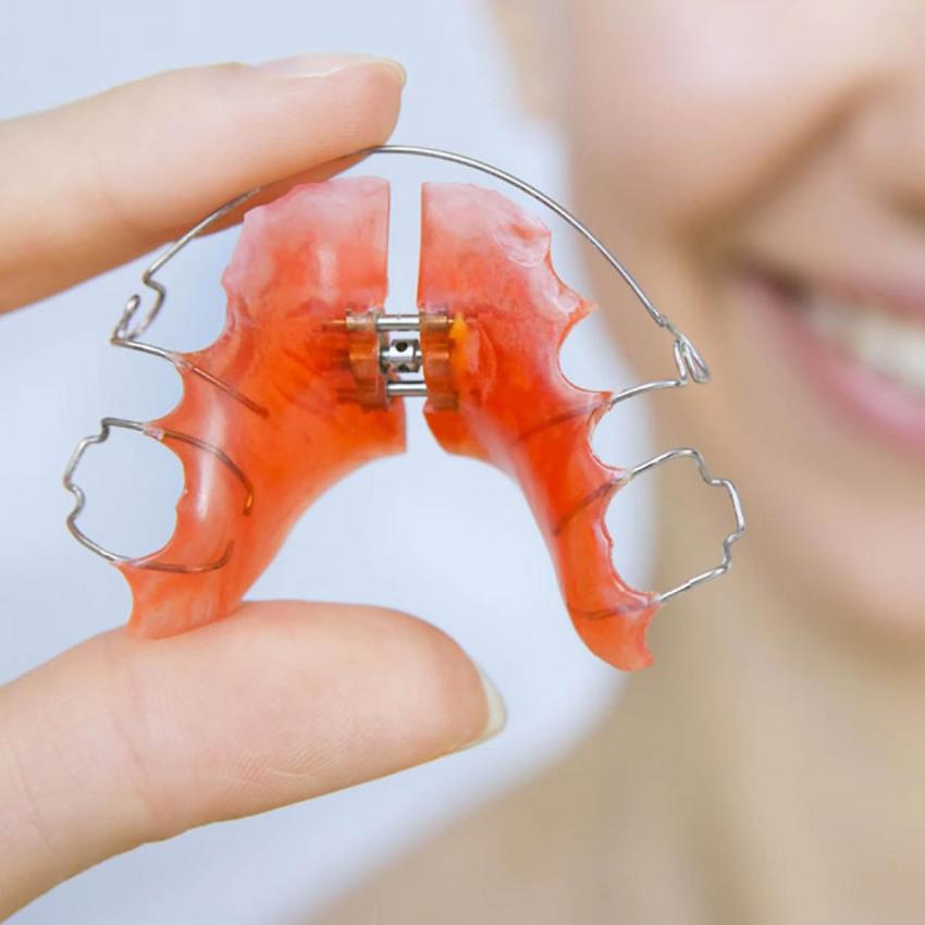 Последствия ортодонтического лечения
