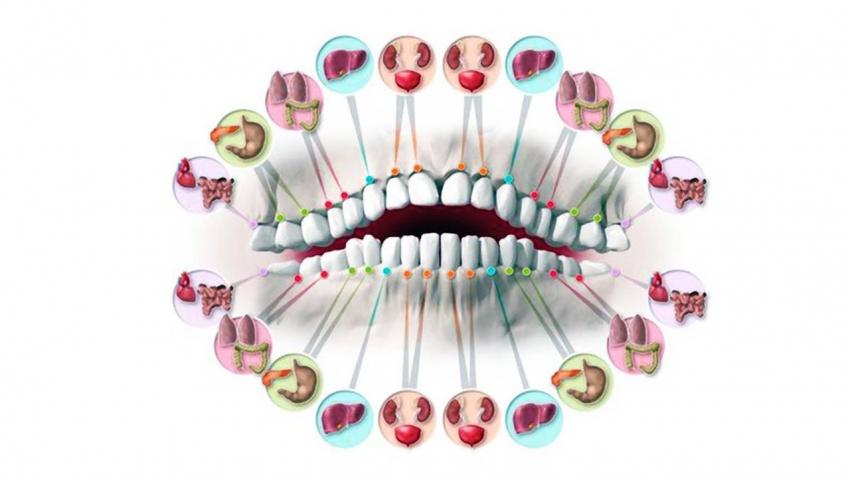 Связь между здоровьем зубов и общим состоянием здоровья
