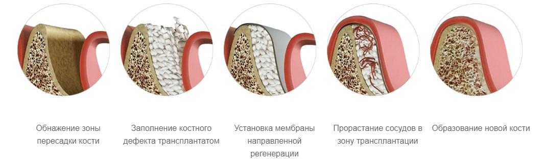 нкр что это такое стоматология. Смотреть фото нкр что это такое стоматология. Смотреть картинку нкр что это такое стоматология. Картинка про нкр что это такое стоматология. Фото нкр что это такое стоматология