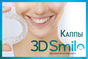 Ортодонтические каппы 3D Smile